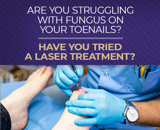 banner laser treatment for fungus toenails